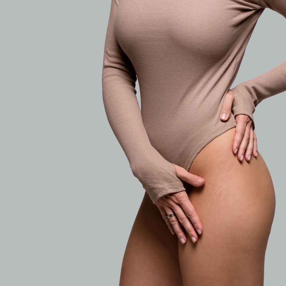 Perfect female figure in a beige bodysuit. Girl is in good shape, has a toned body, healthy skin, slender legs and smooth skin in the bikini area. Stretch marks are visible on the thighs